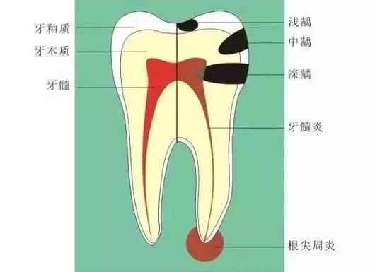 牙痛的用药技巧你知道多少,儿童牙痛用药
