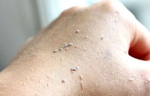 不定期去脸部角质,不按时去角质就来不及了