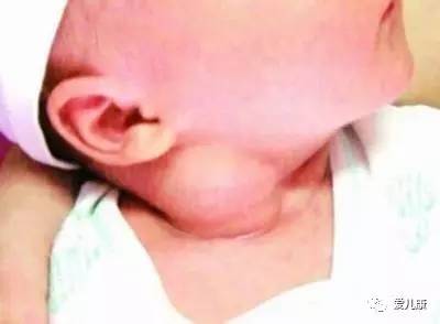 宝宝爱歪头睡怎么纠正,宝宝特别爱歪头是什么原因