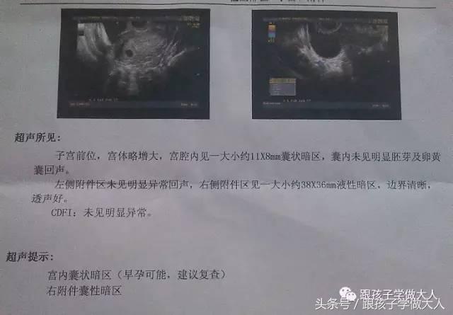 准妈去医院验孕用的是哪种方法？这些方法你可能听都没听过！