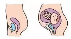 孕期最尴尬的九件事,孕期有可能会遇到的5件尴尬事