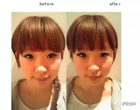 怎么用杯子瘦脸 (用玻璃杯如何瘦脸)