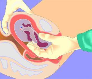 顺产生孩子的痛感,女人生孩子的疼相当于几级疼