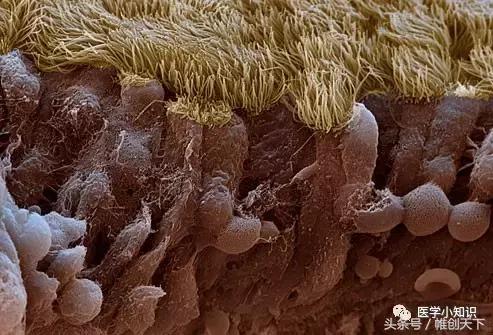 鼻窦炎临床治愈案例,鼻窦炎图片和治疗方法