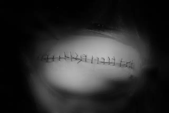 镜头见证生命重启之旅，纪录医者仁心，许昌外科医生的新年故事