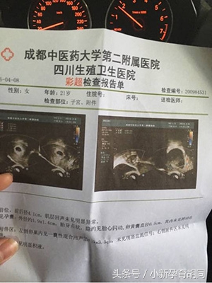 顺产日记小宝宝,顺产日记出生了男宝