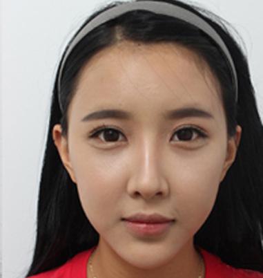 眼袋对形象影响有多大?看看你就都知道了!