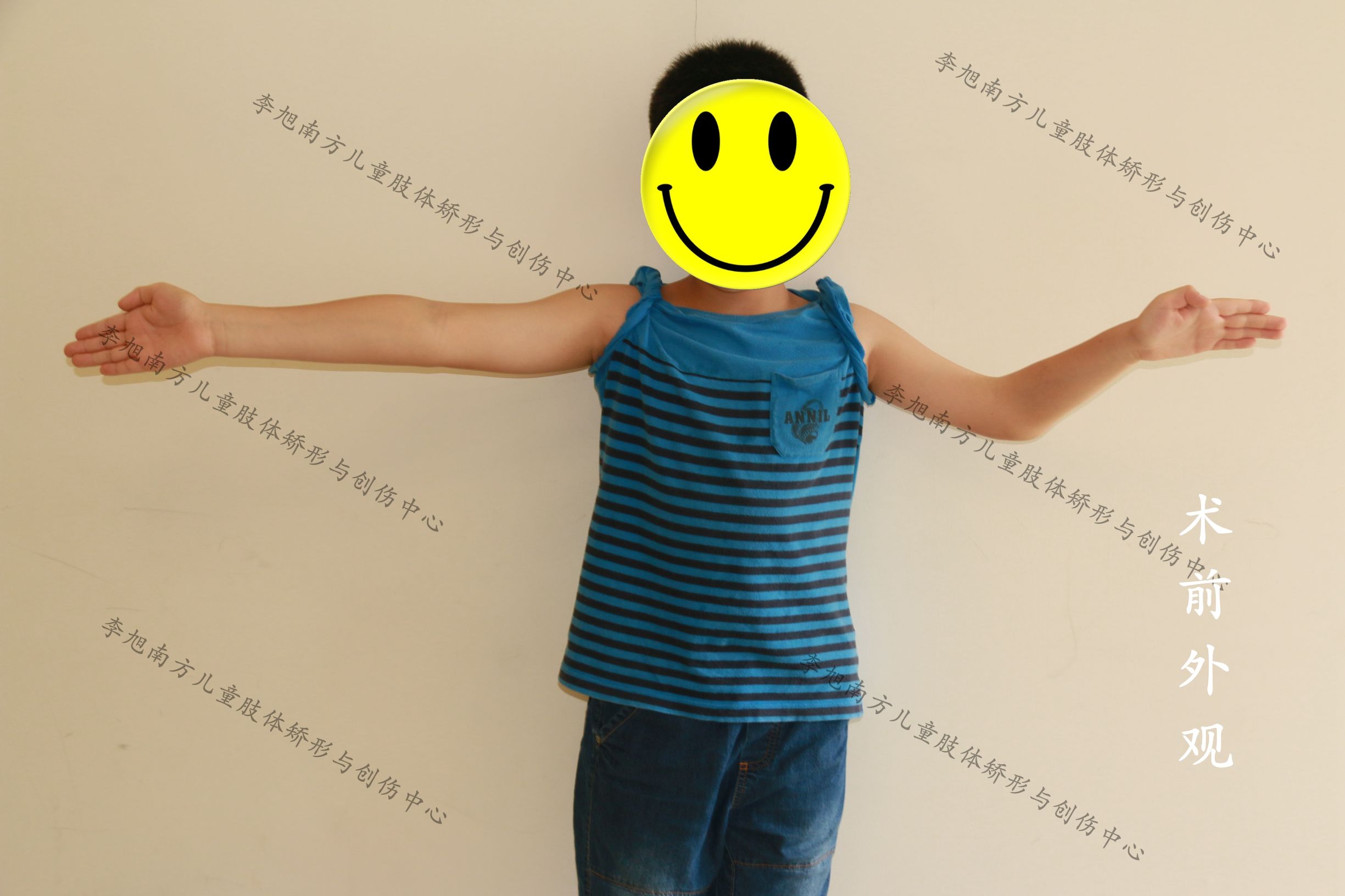 孩子胳膊摔伤后伸不直怎么办,小孩摔了跤胳膊伸不直是怎么回事