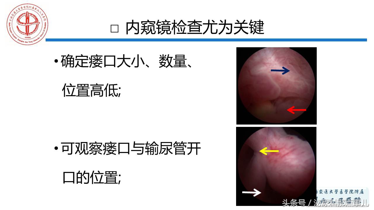 泌尿男科王忠教授,泌尿外科专家王忠教授