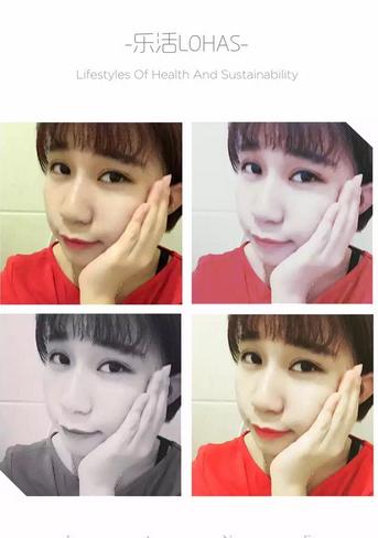 韩式三点双眼皮恢复单眼皮,韩式三点式双眼皮是永久性的吗