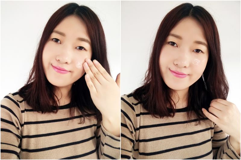 封闭型粉刺怎么弄才比较好？