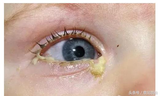 狗红眼病的症状和治疗方法,红眼病的引发原因