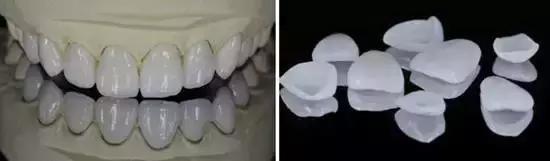 关于牙齿美白你需要知道的哪些事,牙齿美白方法干货分享