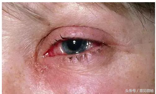 狗红眼病的症状和治疗方法,红眼病的引发原因