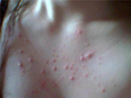 女性出现什么症状需要警惕,女性身体出现这些异样表现