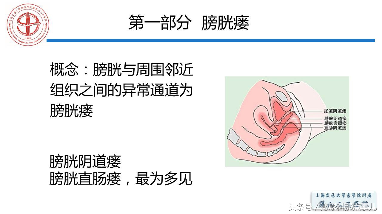 泌尿男科王忠教授,泌尿外科专家王忠教授