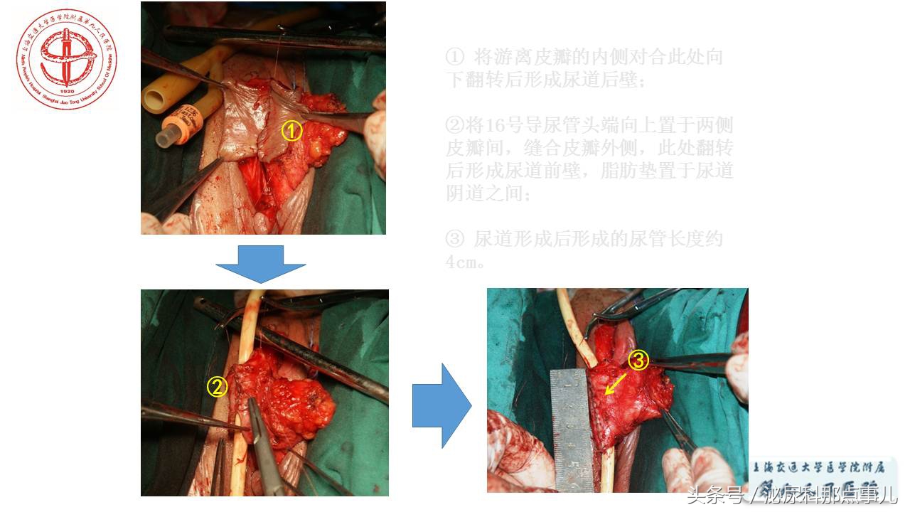泌尿男科王忠教授,泌尿外科专家王忠教授