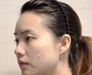 美白的坑你踩过哪些,美白不要急于求成