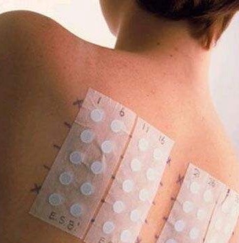 手起透明的小水泡怎么回事汗疱疹,手上起小水泡汗疱疹是真菌感染吗