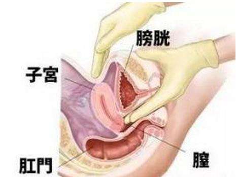 每次检查都让医生哭笑不得，内检简直有毒