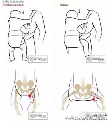 背带和背巾哪种更好用,腰凳背娃神器0-3岁背带怎么用
