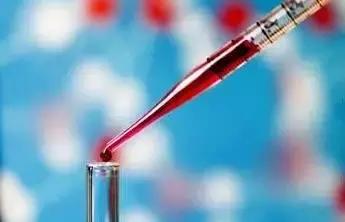 血小板减少性紫癜是大病吗好治吗,血小板减少紫癜是什么病能治好吗