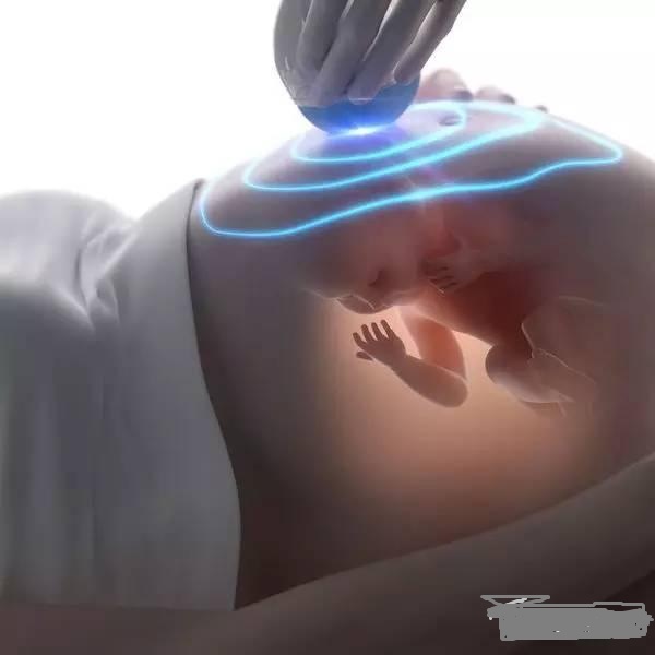 怀孕后做几次B超,怀孕后要来做几次B超