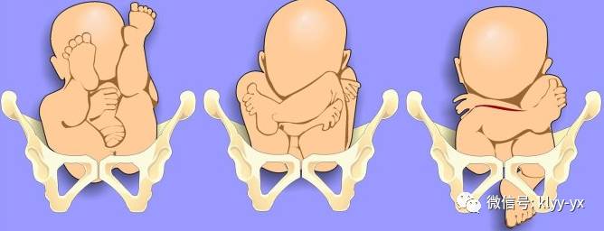 分娩最好的方法,顺产怎么分娩最快最有效