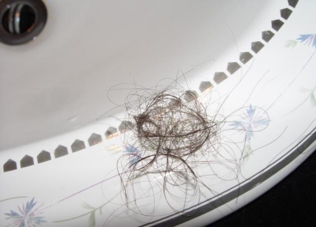 年轻人脱发的原因有什么食疗办法,年轻人脱发有白头发是什么原因