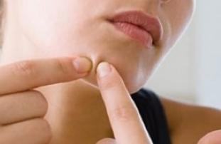 下巴两边脖子长痘痘是什么原因,嘴巴下巴周围长痘痘是什么原因