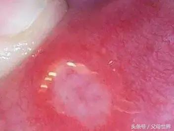 一招解决宝宝不爱喝奶,别再错怪孩子了