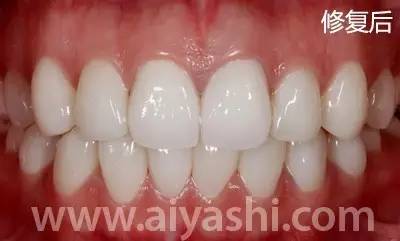 我们的牙齿是怎么来的,我们的牙齿是哪来的