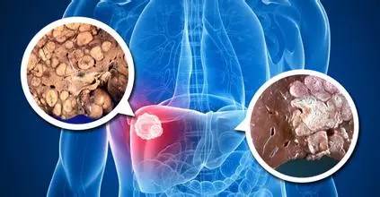 如何实现对熬夜肌体的有效修复？