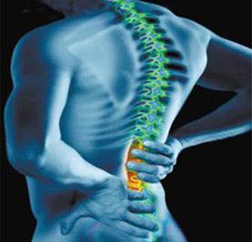 强直性脊柱炎的治疗方法,强直性脊柱炎如何养活自己