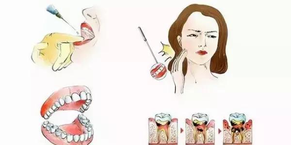 补牙常识,补牙也不知道用的什么材料