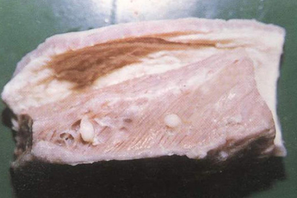 猪肉寄生虫感染解决办法,未煮熟的猪肉容易患哪些寄生虫病