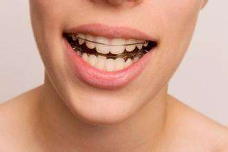 刚刚做了牙齿矫正保持器很难受,哪些人牙齿矫正保持器要戴一辈子