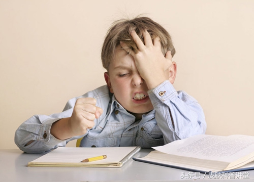 头皮屑多且脂溢性皮炎,头皮屑多头痒脂溢性皮炎