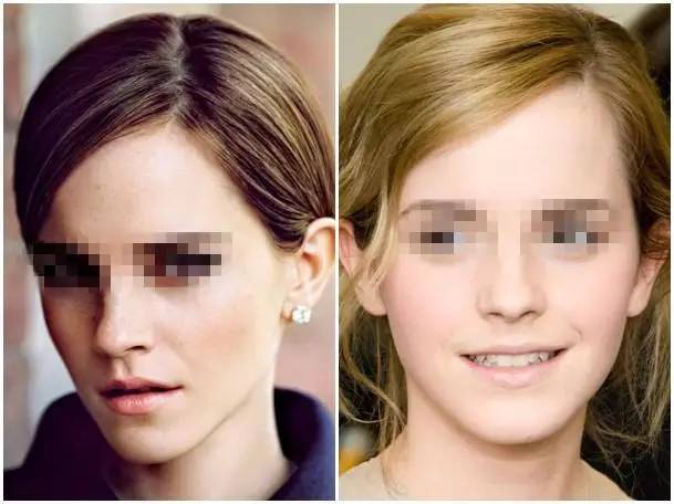 美女与野兽|天生法令纹只能靠整容吗?那是因为你没看这篇!