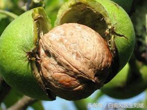 这么多年都吃错了?核桃不能补脑,但能治白癜风!
