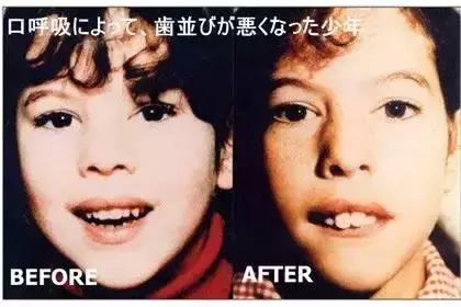 是谁将孩子推入网络深渊,是谁把宝宝推下了台阶