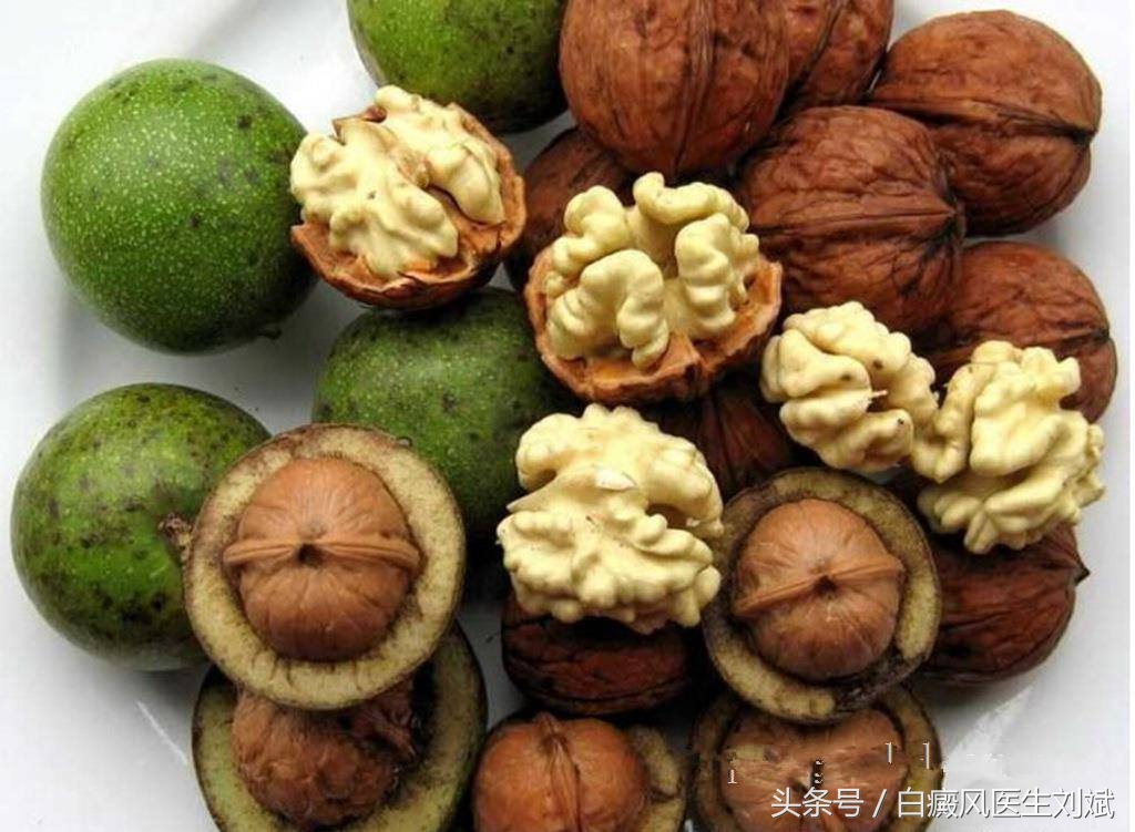 这么多年都吃错了?核桃不能补脑,但能治白癜风!
