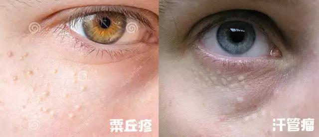 化妆品科普辟谣,辟谣这些美容流言你都信了多少年