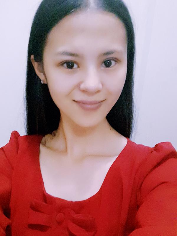 全切双眼皮15天,恢复的差不多了