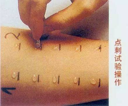 中医如何看待季节性脸部过敏,治疗春季过敏小妙招