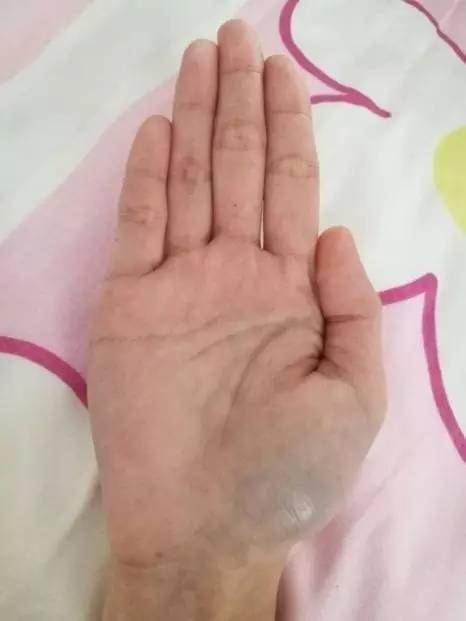 什么样的手相容易为情所困,手相怎么看是不是劳累命