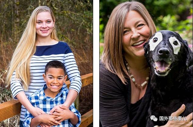 患白癜风男孩,小男孩白癜风