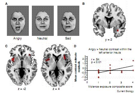 虐待儿童的心理,儿童虐待的精神分析