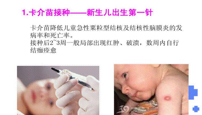 常见肺结核症状及治疗,预防和治疗肺结核最好的办法