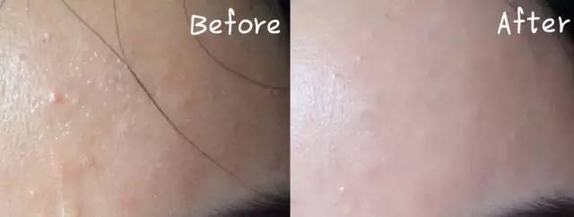 城野医生毛孔收敛水怎么用,城野医生毛孔细致水和收敛水区别